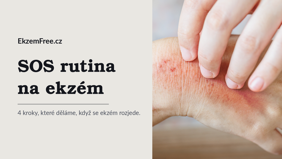 SOS rutina na ekzém